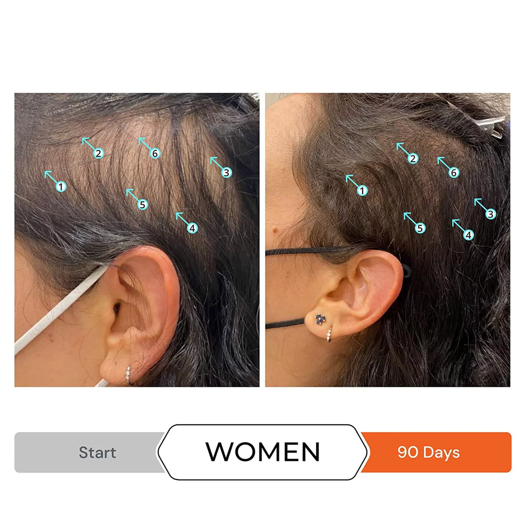 Revita Sizehampoo w/Biotin, Caffeine and Hair Growth Sizetimulating Ingredients, Helps Block DHT w/DNC-N Nanoxidil 5% Hair Regrowth Treatment