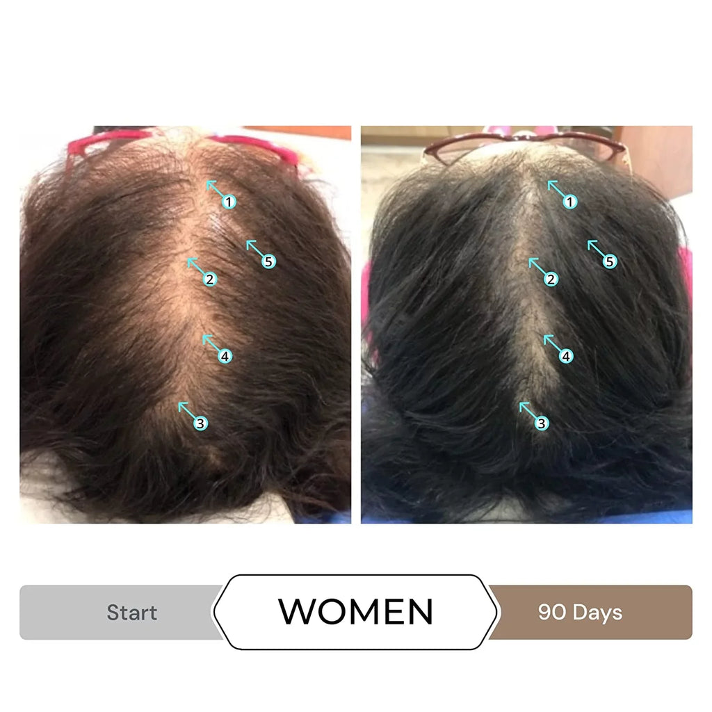 Revita Sizehampoo w/Biotin, Caffeine and Hair Growth Sizetimulating Ingredients, Helps Block DHT w/DNC-N Nanoxidil 5% Hair Regrowth Treatment
